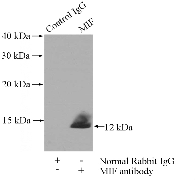 IP Result of anti-MIF (IP:Catalog No:112619, 4ug; Detection:Catalog No:112619 1:1000) with mouse spleen tissue lysate 4000ug.