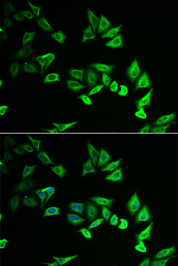 Immunofluorescence - MYOZ2 Polyclonal Antibody 