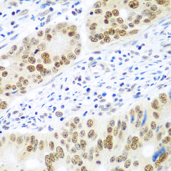 Immunohistochemistry - MDC1 Polyclonal Antibody 
