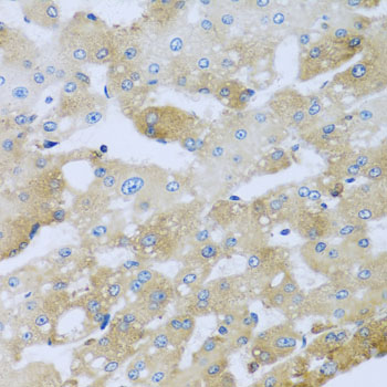 Immunohistochemistry - AP1M2 Polyclonal Antibody 