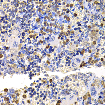 Immunohistochemistry - UBE2V2 Polyclonal Antibody 