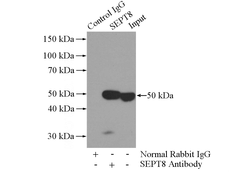 IP Result of anti-SEPT8 (IP:Catalog No:115122, 3ug; Detection:Catalog No:115122 1:1000) with HeLa cells lysate 2000ug.