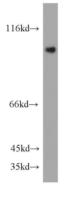 HepG2 cells were subjected to SDS PAGE followed by western blot with Catalog No:109840(DDX58 antibody) at dilution of 1:300