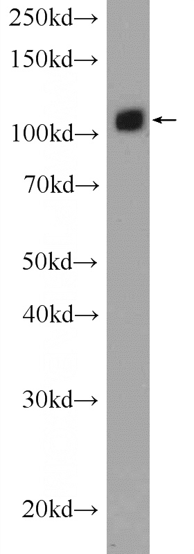 mouse brain tissue were subjected to SDS PAGE followed by western blot with Catalog No:116592(USP15 Antibody) at dilution of 1:1000