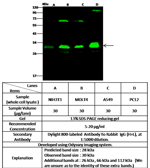 Human PSMA3 / Proteasome 20S alpha 3 Western blot (WB) 15671