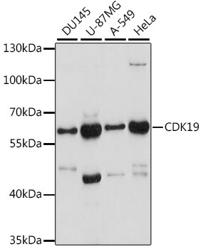 Western blot - CDK19 Polyclonal Antibody 