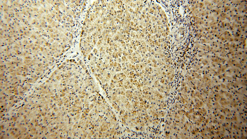 Immunohistochemical of paraffin-embedded human liver using Catalog No:114769(RNMTL1 antibody) at dilution of 1:100 (under 10x lens)