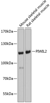 Western blot - PIWIL2 Polyclonal Antibody 