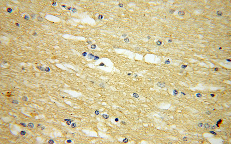 Immunohistochemical of paraffin-embedded human brain using Catalog No:116742(VEZT antibody) at dilution of 1:100 (under 40x lens)