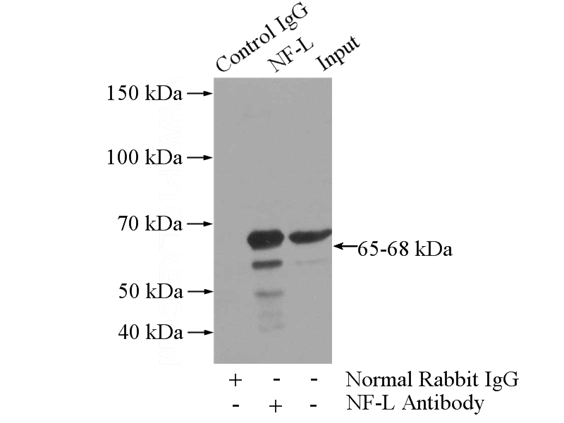 IP Result of anti-NEFL (IP:Catalog No:113162, 4ug; Detection:Catalog No:113162 1:1000) with mouse brain tissue lysate 4000ug.