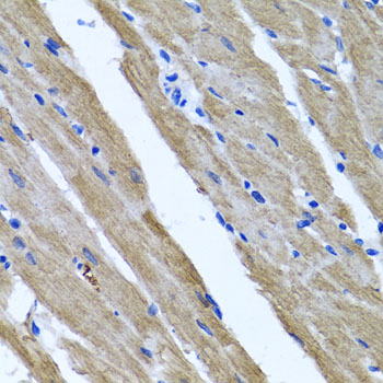 Immunohistochemistry - DFNA5 Polyclonal Antibody 