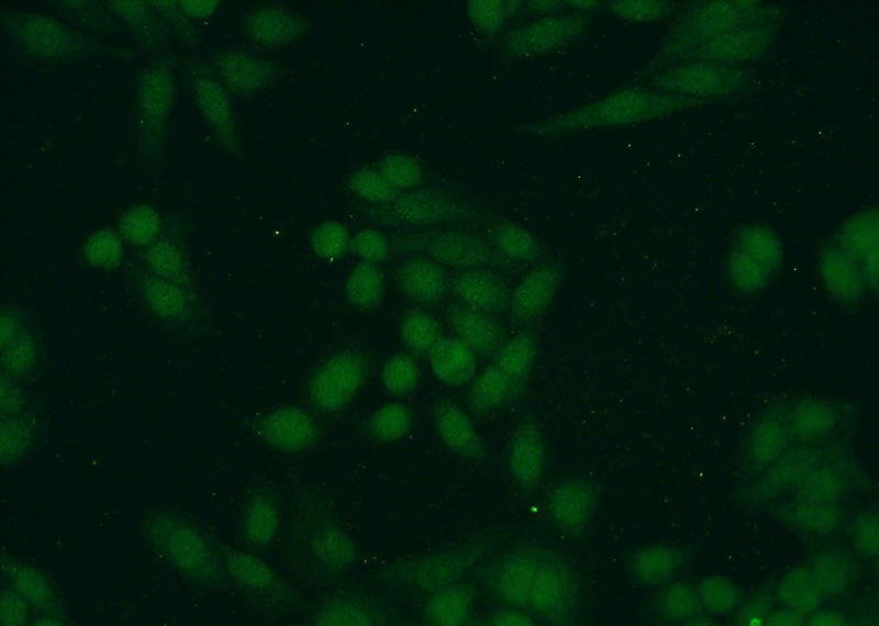 Immunofluorescent analysis of HeLa cells using Catalog No:115042(SAE1 Antibody) at dilution of 1:50 and Alexa Fluor 488-congugated AffiniPure Goat Anti-Rabbit IgG(H+L)