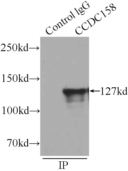 IP Result of anti-CCDC158 (IP:Catalog No:108966, 4ug; Detection:Catalog No:108966 1:500) with mouse testis tissue lysate 6000ug.