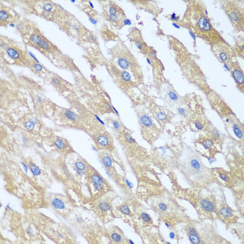 Immunohistochemistry - PPP4R1 Polyclonal Antibody 