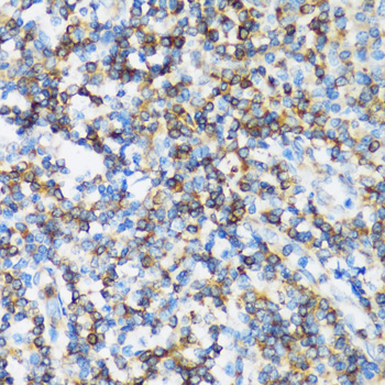 Immunohistochemistry - ARHGEF1 Polyclonal Antibody 
