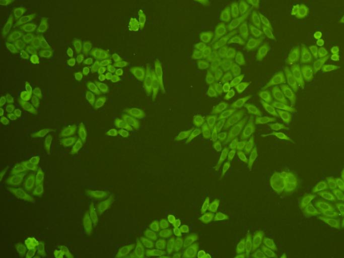 Fig4: ICC staining cMet in HepG2 cells (green). Cells were fixed in paraformaldehyde, permeabilised with 0.25% Triton X100/PBS.