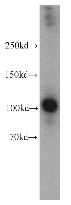 mouse pancreas tissue were subjected to SDS PAGE followed by western blot with Catalog No:114922(RRBP1 antibody) at dilution of 1:800
