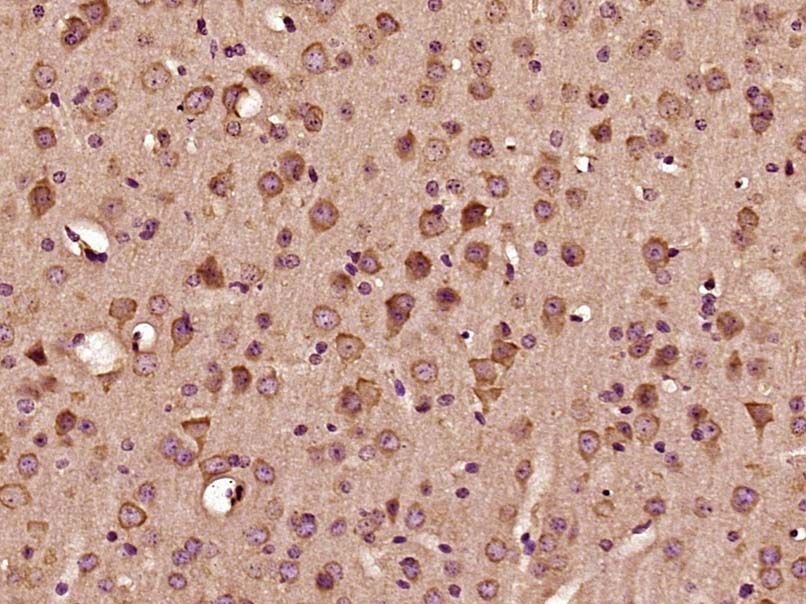 Fig2: Paraformaldehyde-fixed, paraffin embedded (Mouse brain); Antigen retrieval by boiling in sodium citrate buffer (pH6.0) for 15min; Block endogenous peroxidase by 3% hydrogen peroxide for 20 minutes; Blocking buffer (normal goat serum) at 37℃ for 30min; Antibody incubation with (GPR107) Polyclonal Antibody, Unconjugated at 1:500 overnight at 4℃, followed by a conjugated secondary (sp-0023) for 20 minutes and DAB staining.
