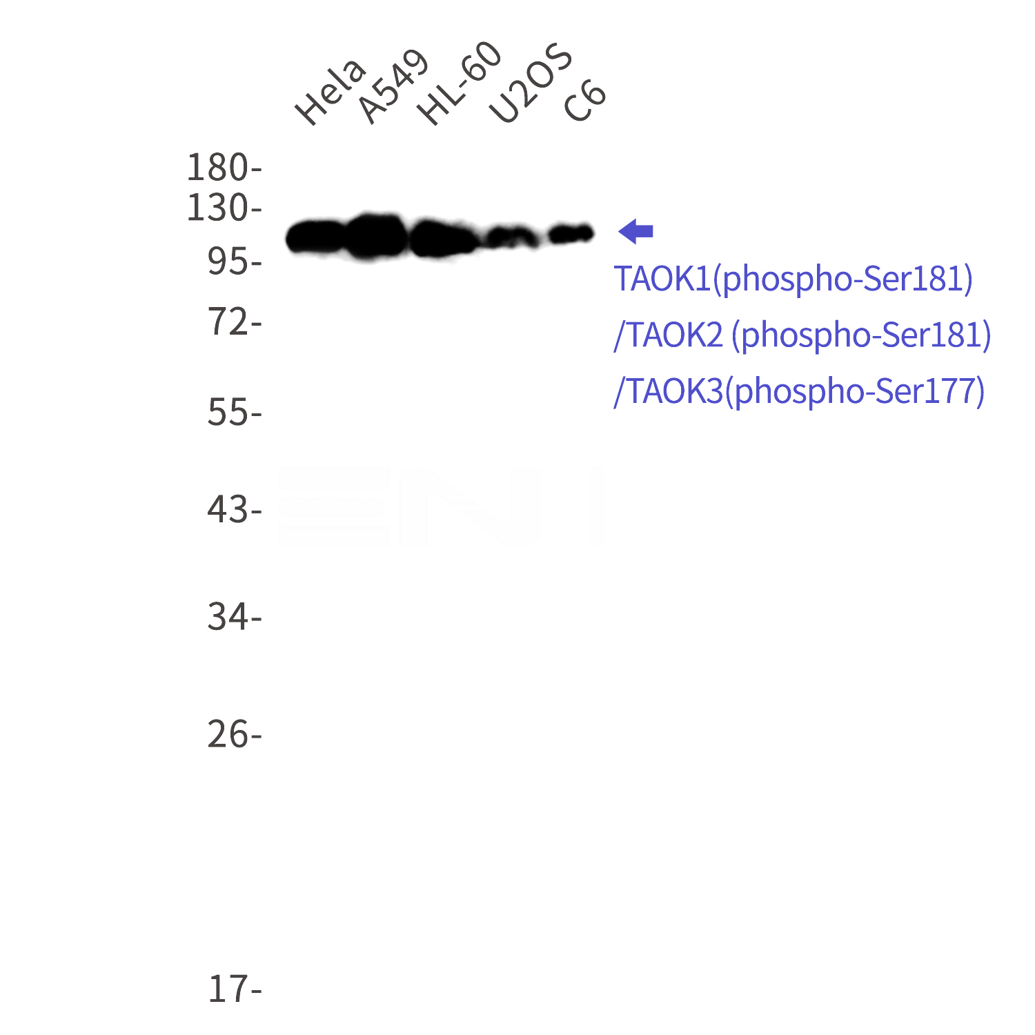Western blot detection of TAOK1 (phospho-Ser181)/TAOK2 (phospho-Ser181)/TAOK3 (phospho-Ser177) in Hela,A549,HL-60,U2OS,C6 cell lysates using TAOK1 (phospho-Ser181)/TAOK2 (phospho-Ser181)/TAOK3 (phospho-Ser177) Rabbit mAb(1:1000 diluted).Predicted band size:105,116,138kDa.Observed band size:105,116,138kDa.