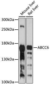 Western blot - ABCC6 Polyclonal Antibody 