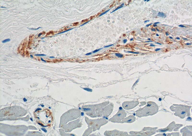 Immunohistochemistry of paraffin-embedded human heart tissue slide using Catalog No:116334(TRANSGELIN-1-specific Antibody) at dilution of 1:2000 (under 40x lens).
