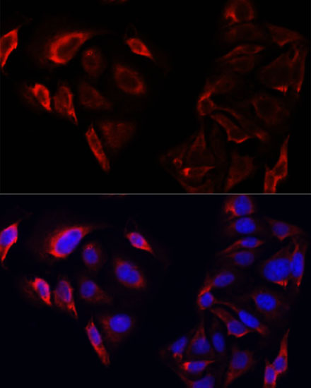 Immunofluorescence - SAA3 Polyclonal Antibody 