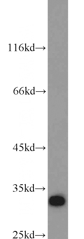 HepG2 cells were subjected to SDS PAGE followed by western blot with Catalog No:115803(SDCBP antibody) at dilution of 1:1000