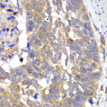 Immunohistochemistry - HAPLN1 Polyclonal Antibody 