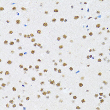 Immunohistochemistry - MTA3 Polyclonal Antibody 