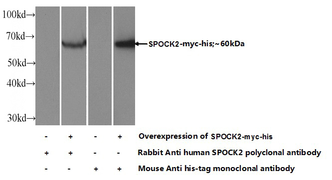 Transfected HEK-293 cells were subjected to SDS PAGE followed by western blot with Catalog No:115579(SPocK2 Antibody) at dilution of 1:1000