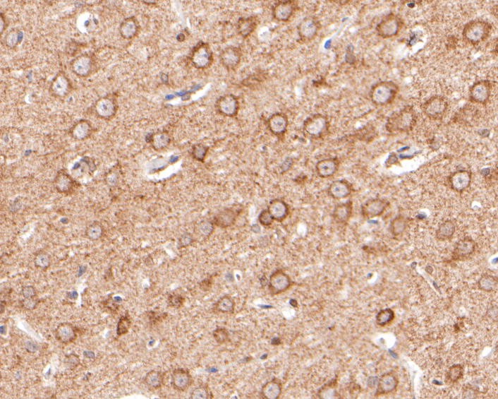 Fig3:; Immunohistochemical analysis of paraffin-embedded rat brain tissue using anti-EPHA2 antibody. The section was pre-treated using heat mediated antigen retrieval with Tris-EDTA buffer (pH 8.0-8.4) for 20 minutes.The tissues were blocked in 5% BSA for 30 minutes at room temperature, washed with ddH; 2; O and PBS, and then probed with the primary antibody ( 1/50) for 30 minutes at room temperature. The detection was performed using an HRP conjugated compact polymer system. DAB was used as the chromogen. Tissues were counterstained with hematoxylin and mounted with DPX.