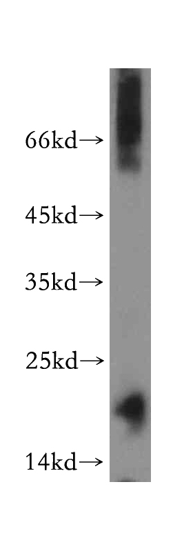 human testis tissue were subjected to SDS PAGE followed by western blot with Catalog No:112417(LYZL6 antibody) at dilution of 1:300