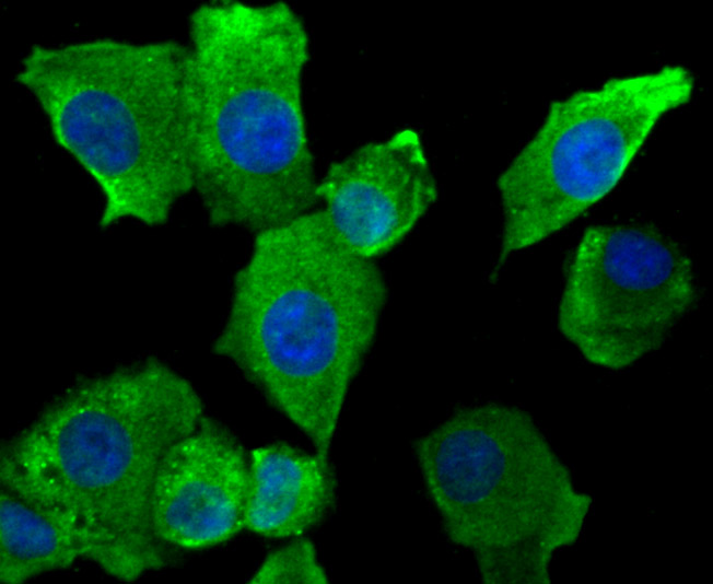 Fig3: ICC staining SFRP1 in A549 cells (green). The nuclear counter stain is DAPI (blue). Cells were fixed in paraformaldehyde, permeabilised with 0.25% Triton X100/PBS.