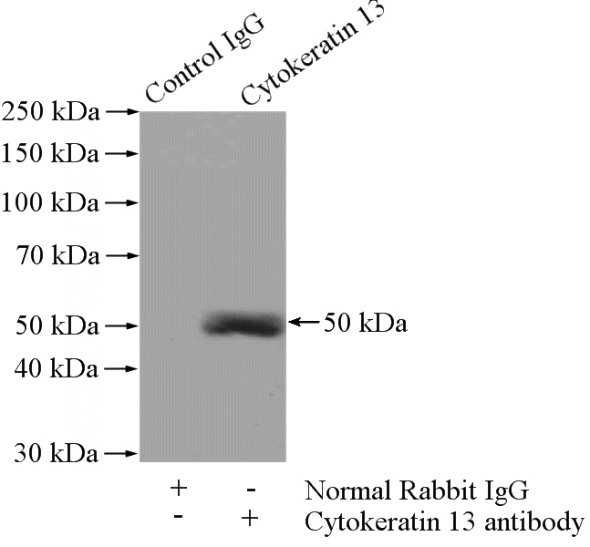 IP Result of anti-KRT13 (IP:Catalog No:109790, 4ug; Detection:Catalog No:109790 1:1000) with A431 cells lysate 2400ug.