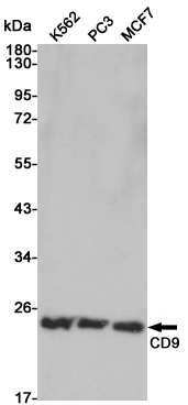 Western blot analysis of CD9 expression in K562,PC3 and MCF7 cell lysates using CD9 antibody at 1/1000 dilution.Predicted band size:25KDa.Observed band size:25KDa.