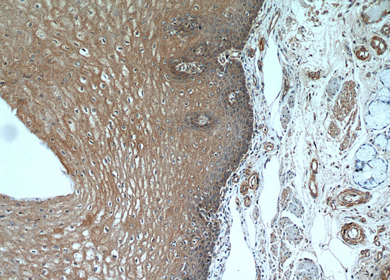 Immunohistochemical of paraffin-embedded human oesophagus using Catalog No:114312(PTP4A3 antibody) at dilution of 1:50 (under 10x lens)