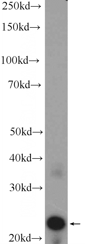 mouse eye tissue were subjected to SDS PAGE followed by western blot with Catalog No:109583(CRYBA2 Antibody) at dilution of 1:2000