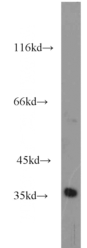mouse kidney tissue were subjected to SDS PAGE followed by western blot with Catalog No:115819(SUCLG1 antibody) at dilution of 1:500