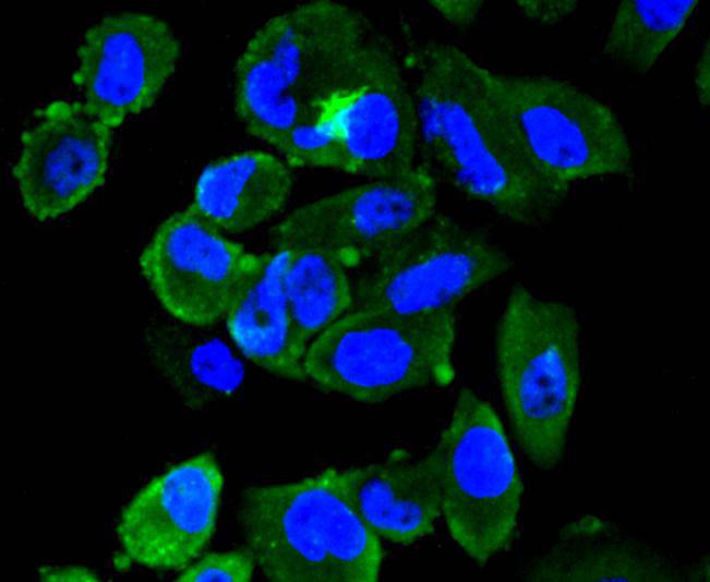 Fig2: Immunocytochemical staining of PC-3M cells using anti-FPR2 rabbit polyclonal antibody.