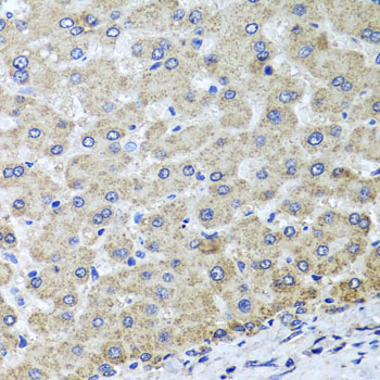 Immunohistochemistry - OSGEPL1 Polyclonal Antibody 