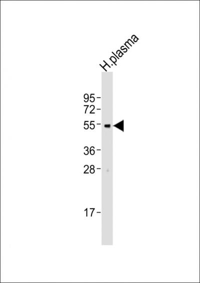 Anti-CD63 Antibody (C-term)at  1:2000 dilution + human plasma lysatesnnLysates/proteins at 20 u03bcg per lane. nnSecondarynGoat Anti-Rabbit IgG,  (H+L), Peroxidase conjugated at 1/10000 dilutionnnPredicted band size: 25 kDannBlocking/Dilution buffer: 5% NFDM/TBST.