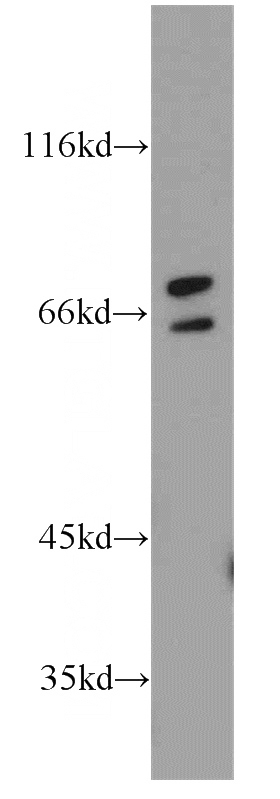 human stomach tissue were subjected to SDS PAGE followed by western blot with Catalog No:115629(ST6GALNAC1 antibody) at dilution of 1:1200