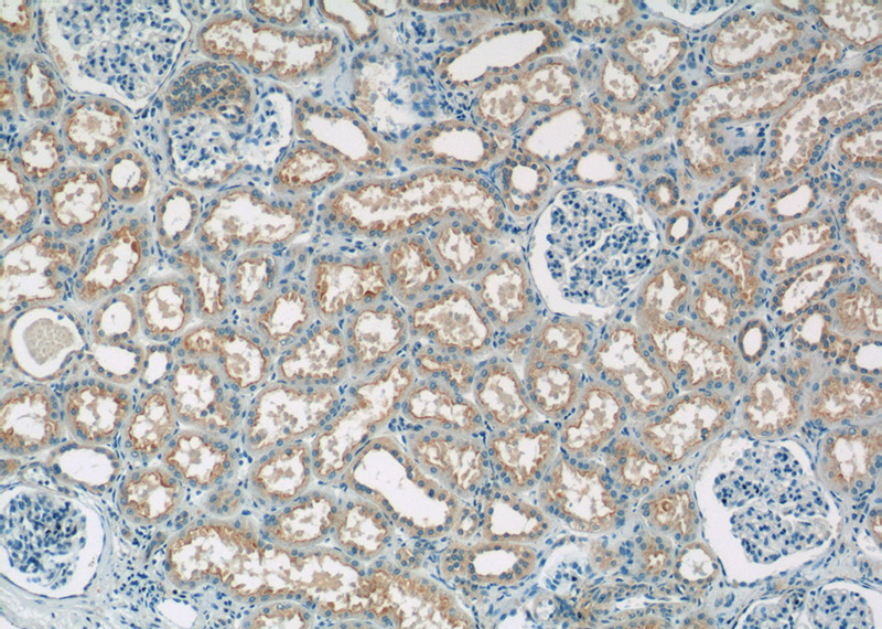 Immunohistochemistry of paraffin-embedded human kidney tissue slide using Catalog No:115447(SNAP29 Antibody) at dilution of 1:50 (under 10x lens)