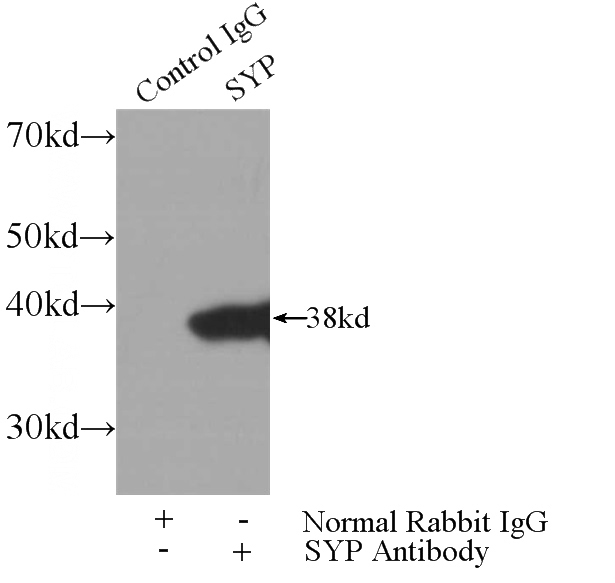 IP Result of anti-Synaptophysin; SYP (IP:Catalog No:115768, 3ug; Detection:Catalog No:115768 1:1000) with mouse brain tissue lysate 4000ug.