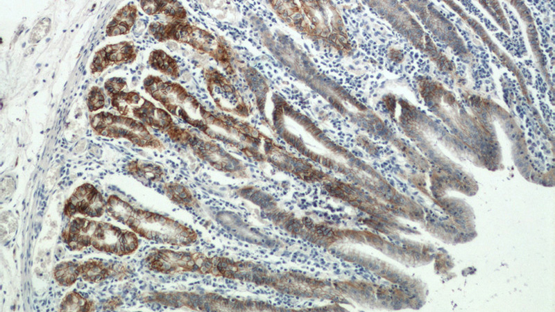 Immunohistochemistry of paraffin-embedded human stomach tissue slide using Catalog No:108808(CA9 Antibody) at dilution of 1:50 (under 10x lens)