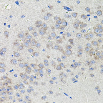 Immunohistochemistry - ATF6 Polyclonal Antibody 