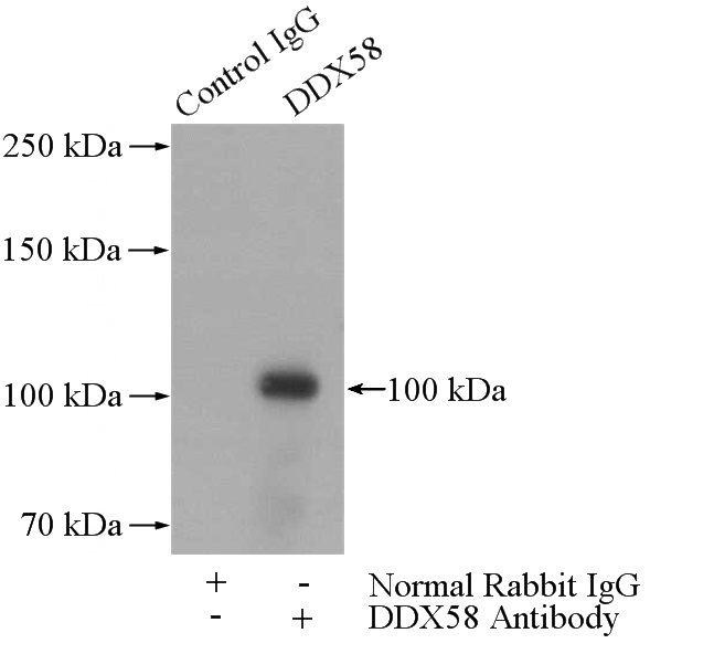 IP Result of anti-DDX58 (IP:Catalog No:109840, 4ug; Detection:Catalog No:109840 1:300) with HepG2 cells lysate 3600ug.