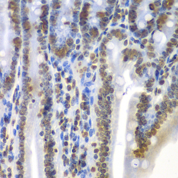 Immunohistochemistry - SEPT7 Polyclonal Antibody 