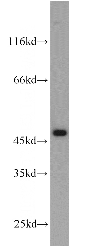 HeLa cells were subjected to SDS PAGE followed by western blot with Catalog No:107790(ADH7 antibody) at dilution of 1:1000