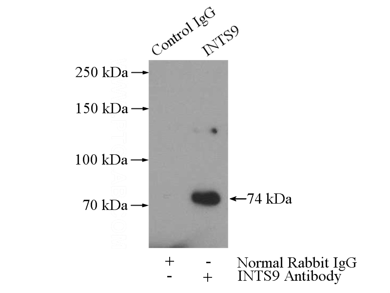 IP Result of anti-INTS9 (IP:Catalog No:111811, 4ug; Detection:Catalog No:111811 1:1000) with HeLa cells lysate 880ug.